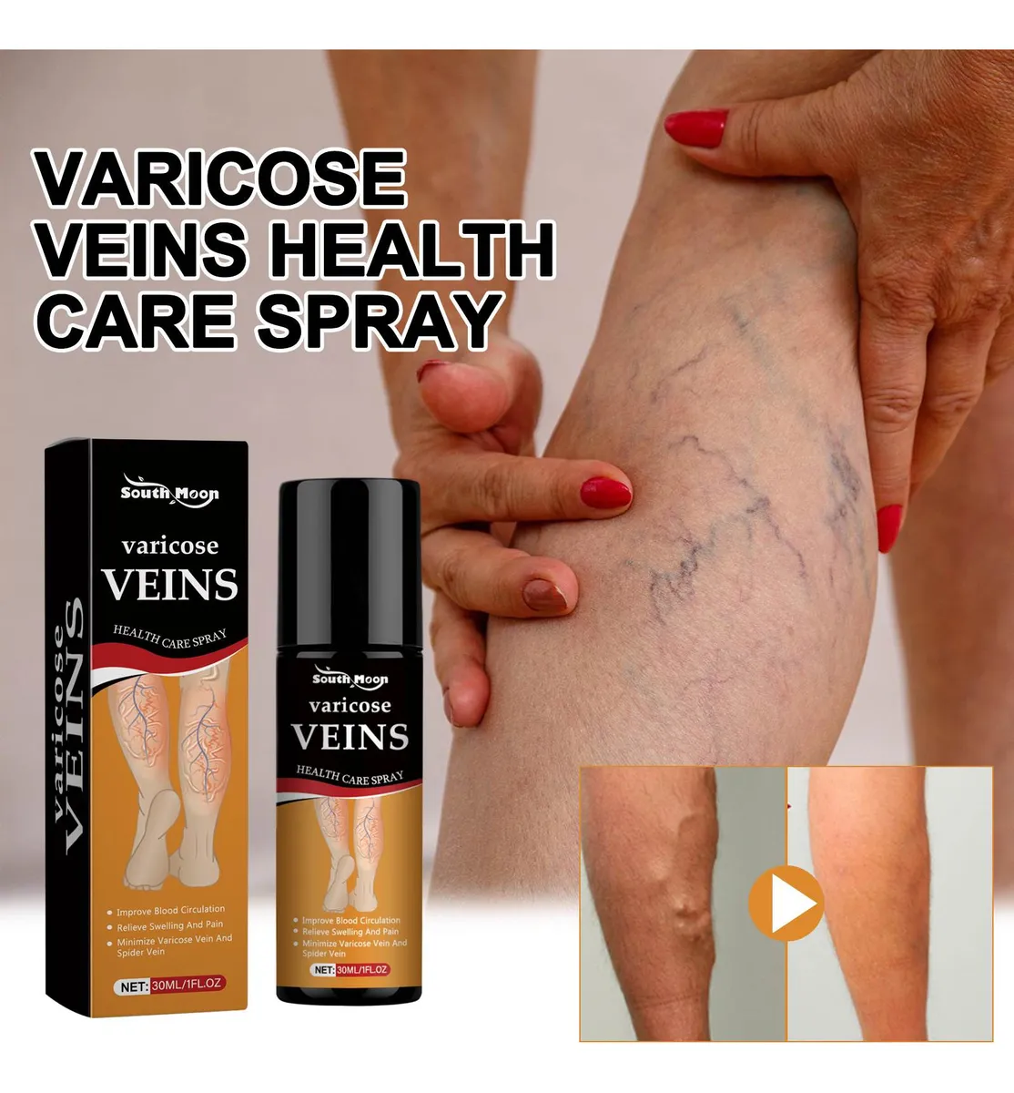 Turmeric Varicose Veins Relief Spray (BUY 1 GET 1 FREE🔥🔥)