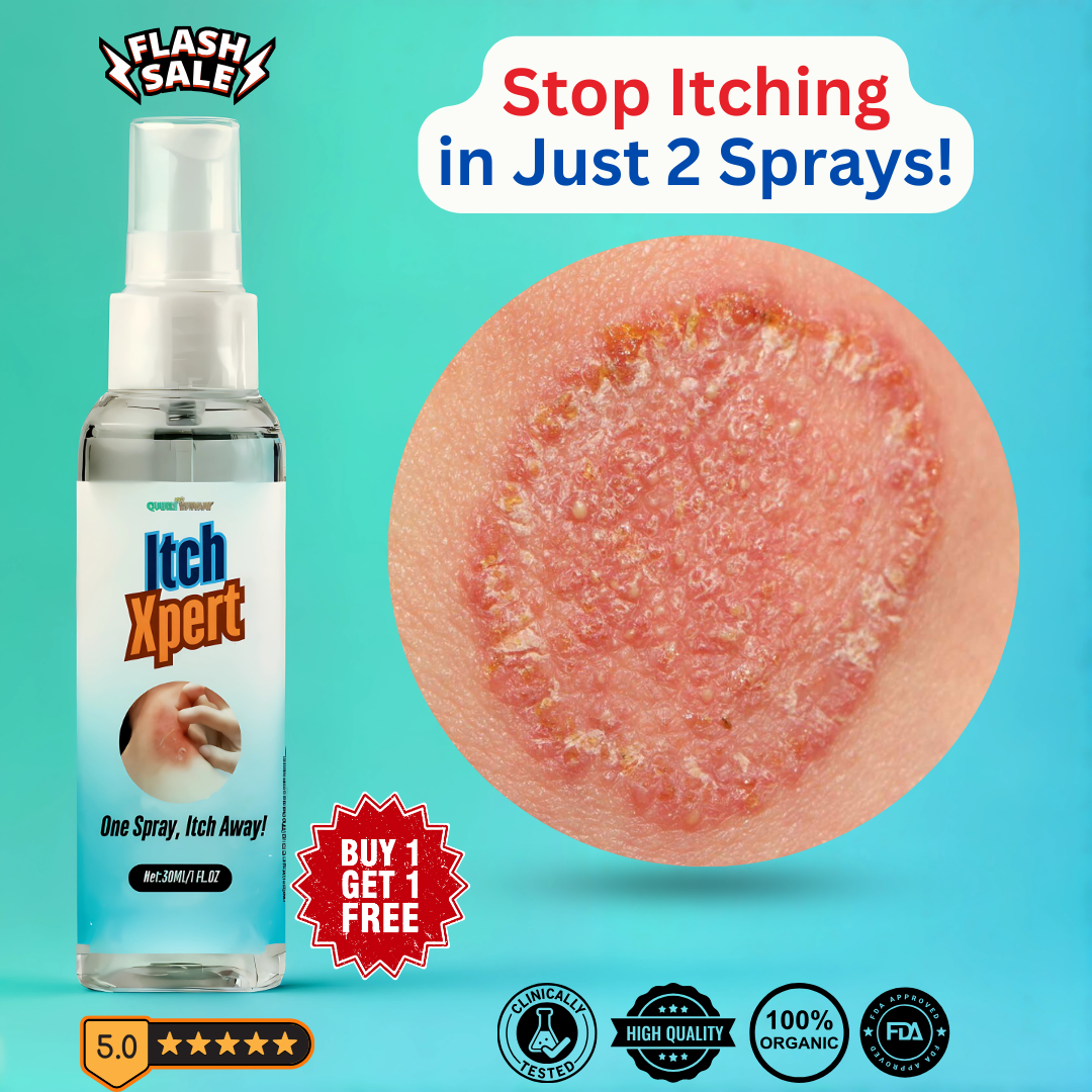 ItchXpert Herbal Anti Fungal Spray - (Buy 1 Get 1 FREE🔥🔥)