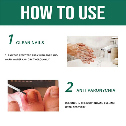Anti Paronychia Relief Oil 🌿 - (Buy 1 Get 1 FREE🔥🔥)
