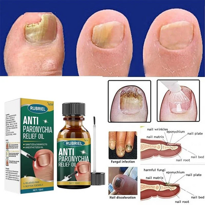 Anti Paronychia Relief Oil 🌿 - (Buy 1 Get 1 FREE🔥🔥)